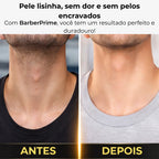 BarberPrime™ - Kit Completo Barbeador Profissional + Brindes