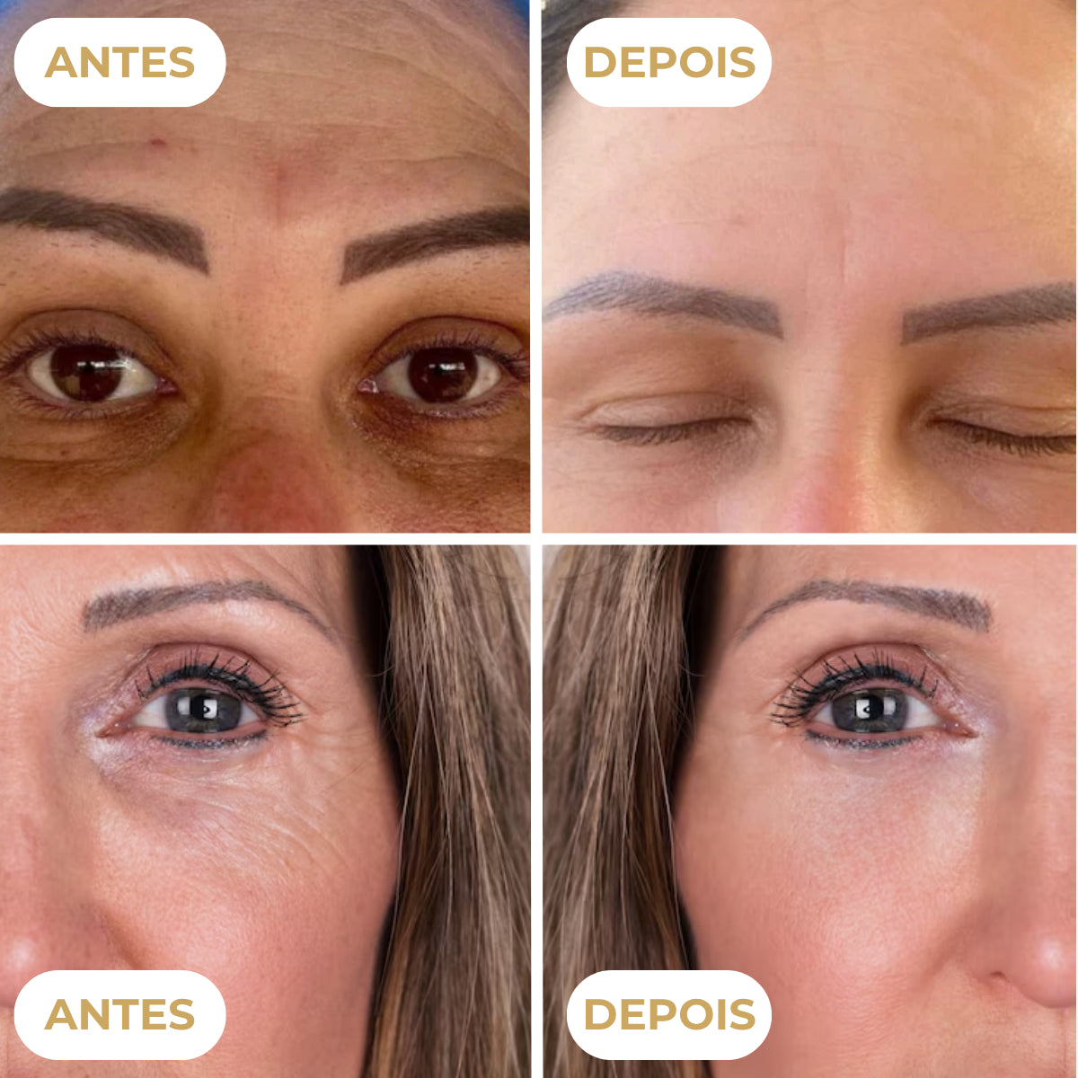 Base Rejuvenescedora Profissional BioAqua™ (Compre 1 Leve 2) + BRINDES